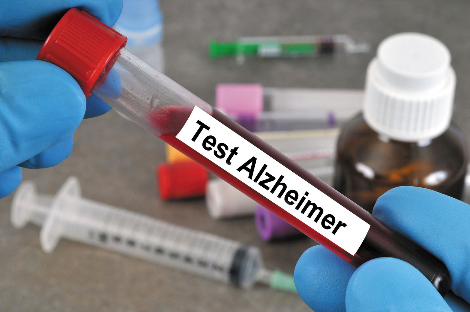 آزمایش خون برای تشخیص آلزایمر