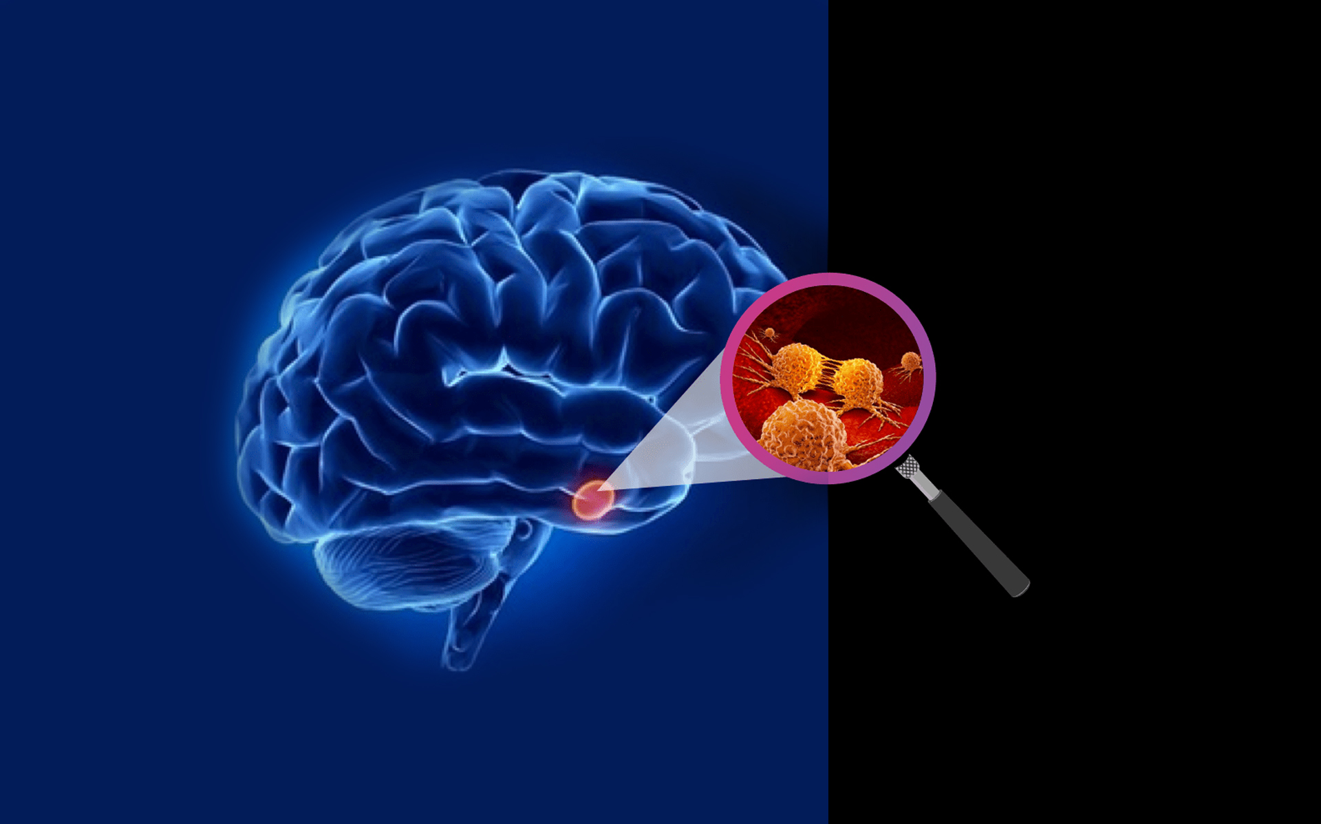 آیا تومور مغزی با ازمایش خون معلوم میشود ؟