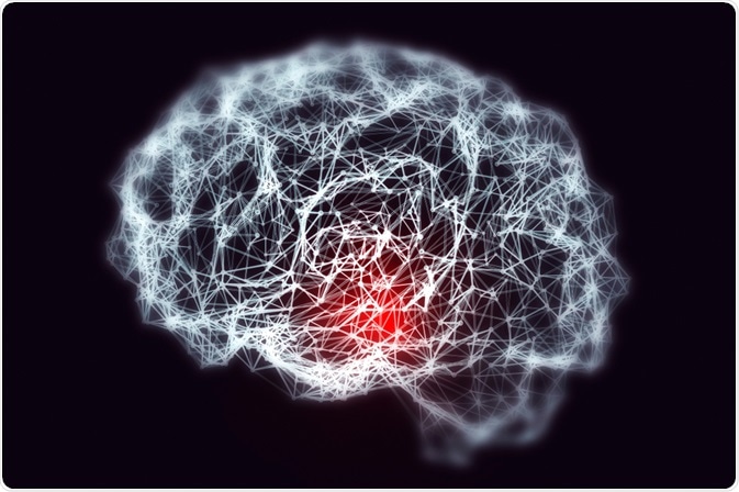 آیا تومور مغزی باعث فراموشی می شود ؟
