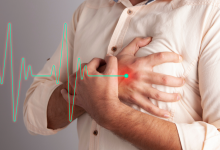 آریتمی قلبی چیست؟ انواع، علائم و درمان آن