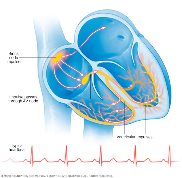 آریتمی قلبی چگونه درمان می شود ؟