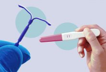 روش های جلوگیری از بارداری آی یو دی IUD