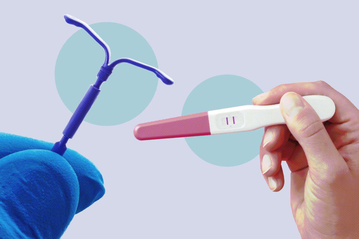 روش های جلوگیری از بارداری آی یو دی IUD