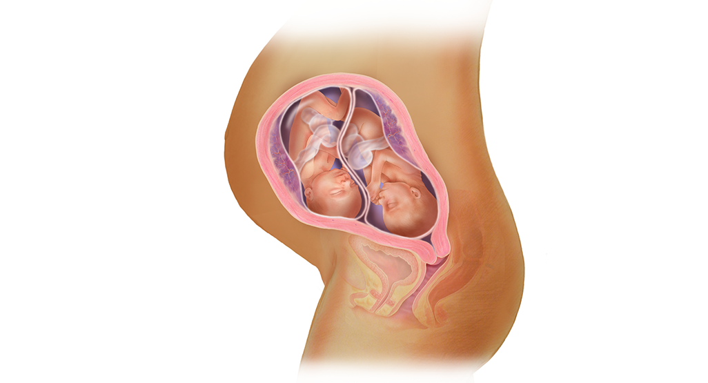 چگونه بارداری دوقلو اتفاق می افتد ؟