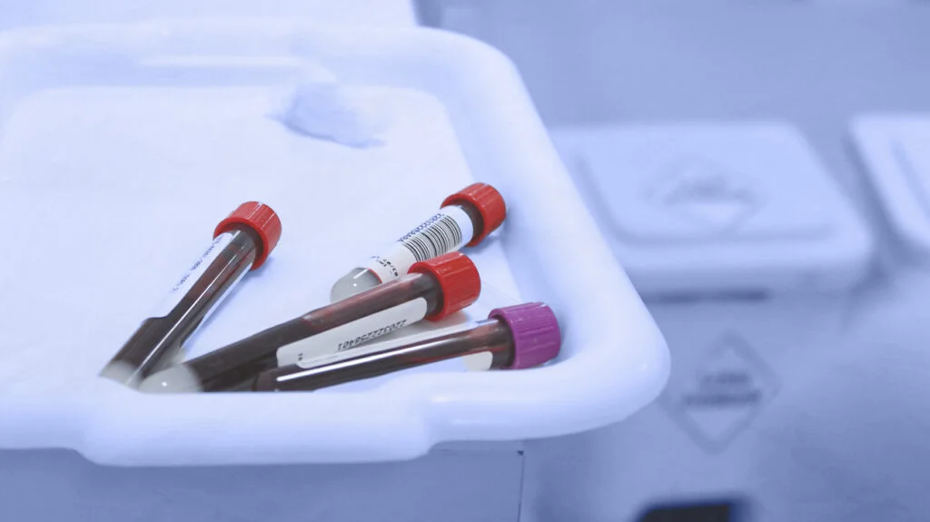 آیا سرطان رحم در آزمایش خون مشخص می شود ؟