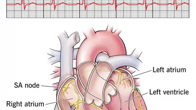 نحوه تشخیص آریتمی قلبی