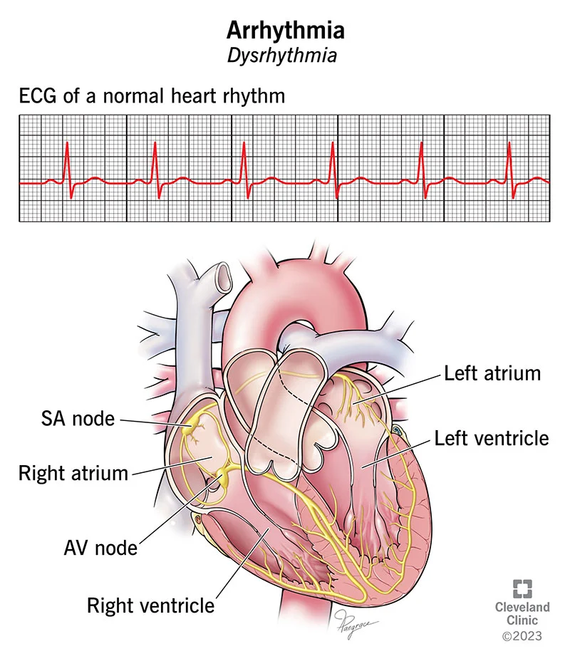 نحوه تشخیص آریتمی قلبی