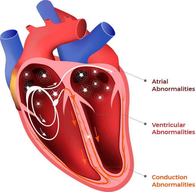 چه چیزهایی برای آریتمی قلب مضر است ؟