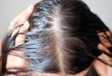 آیا یائسگی باعث ریزش مو می شود ؟