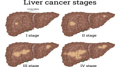 سرطان کبد چگونه به وجود می آید ؟