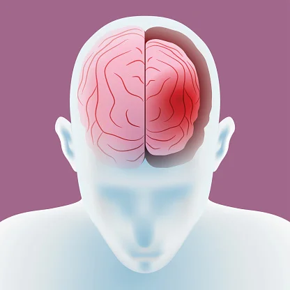 علت کوچک شدن مغز چیست ؟ علائم آتروفی مغز