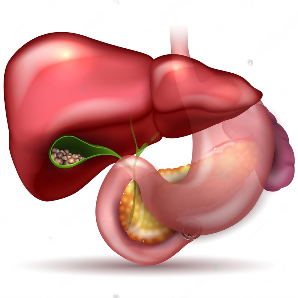 Great home remedy for gallstones2