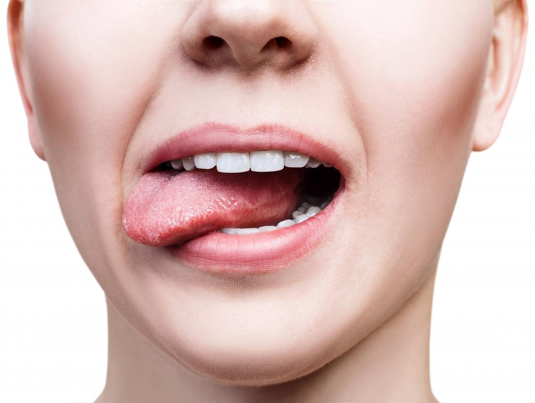 آیا عفونت دندان باعث رفلاکس معده می شود ؟