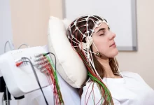 نوار مغز چیست ؟ مزایا و معایت گرفتن الکتروانسفالوگرام (EEG)