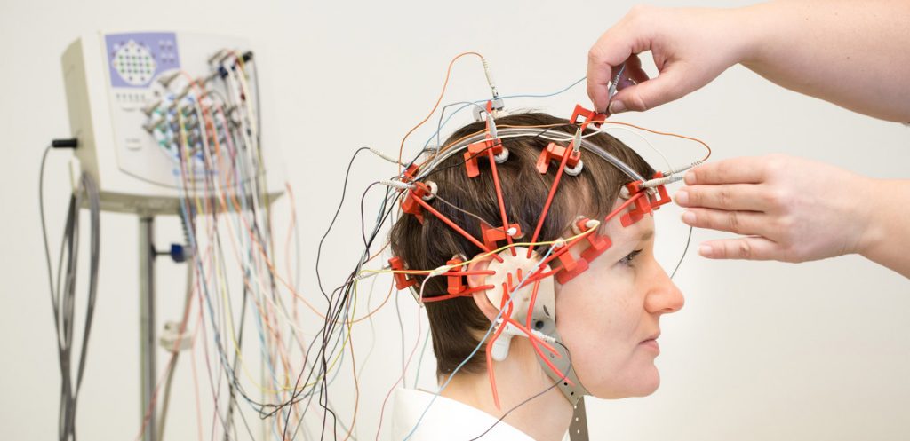 نوار مغز یا الکتروانسفالوگرام (EEG) چگونه گرفته می­شود؟
