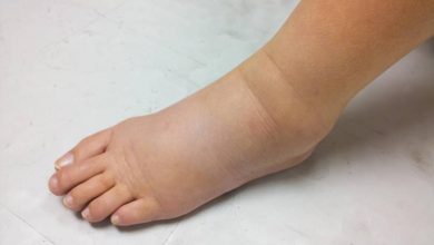 علت ورم پای راست چیست