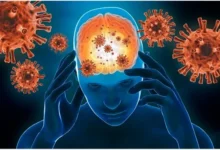 عفونت مغزی چیست؟ تشخیص و درمان آبسه مغزی