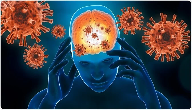 عفونت مغزی چیست؟ تشخیص و درمان آبسه مغزی