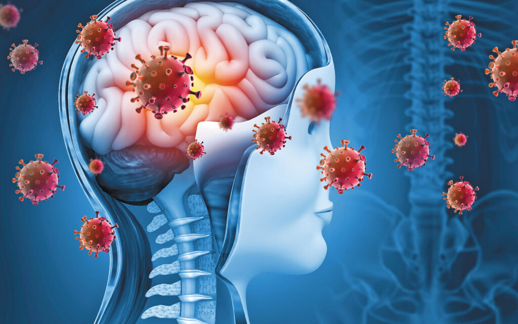 چگونه می توان عفونت مغزی را تشخیص داد؟