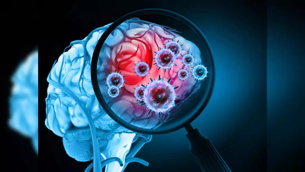 عفونت مغزی چه عوارضی دارد