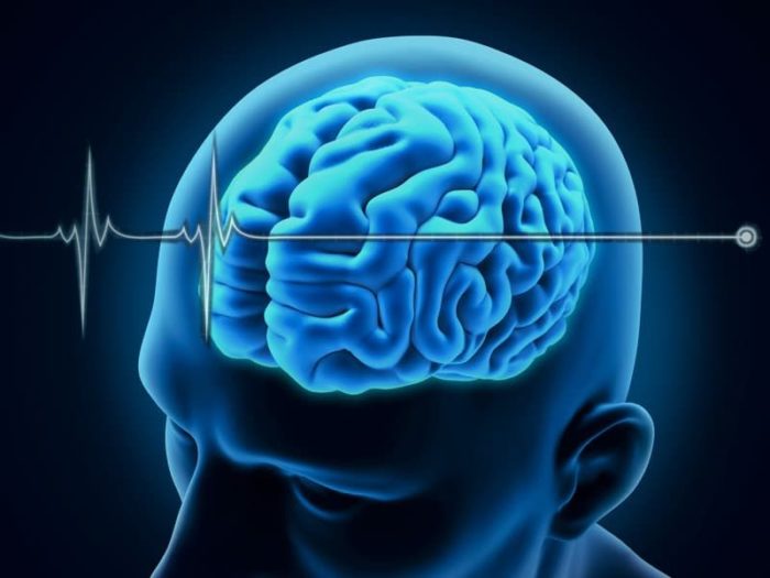آزمایشات تایید مرگ ساقه مغز (مرگ مغزی)
