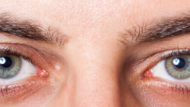 علت و درمان خشکی چشم