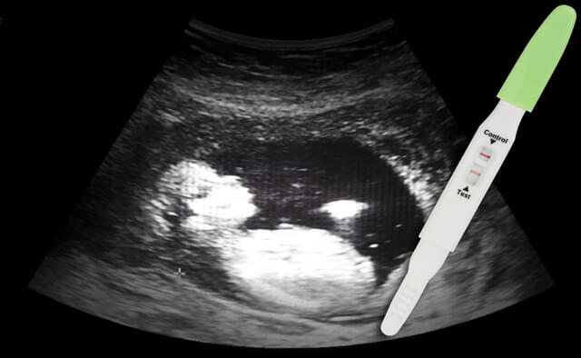 وضعیت جنین در هفته اول بارداری: