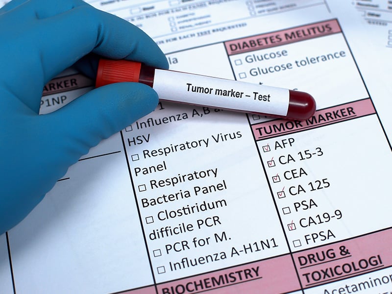 Blood cancer diagnosis by test