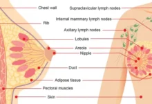 آناتومی سینه (پستان) زنان و بیماری های رایج آن