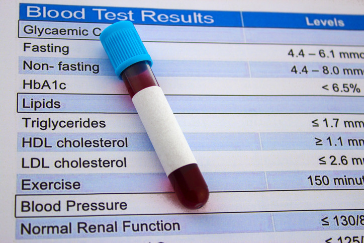 High blood lipid test