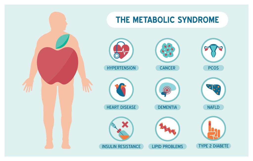 Metabolic syndrome