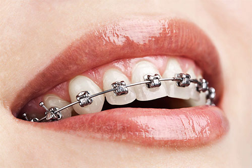 Orthodontic8