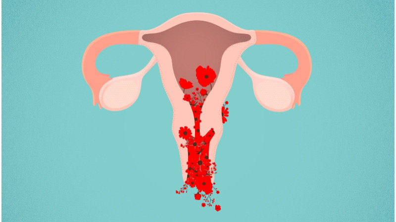 Uterine bleeding