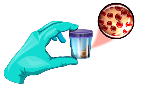 Blood test in stool