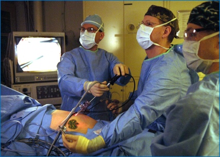 Colon cancer surgery