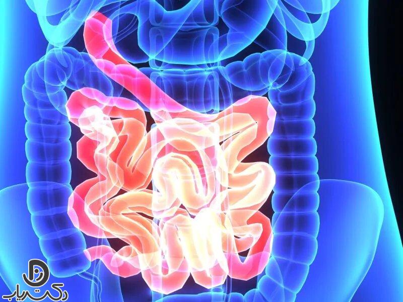 Complications of colonoscopy