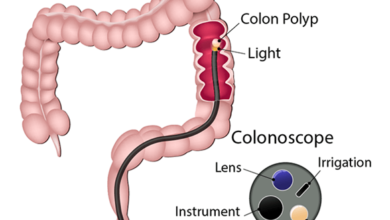 عمل کولونوسکوپی چیست؟ کاربرد و عوارض آن