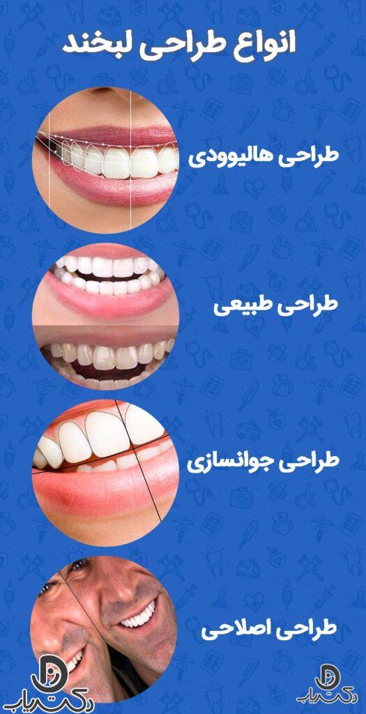 انواع طراحی لبخند