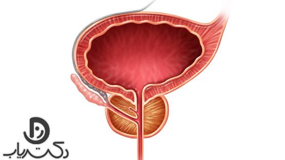 چی باعث بزرگ شدن پروستات می شود