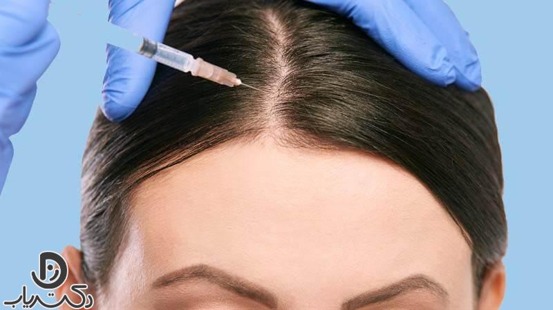 Hair mesotherapy4