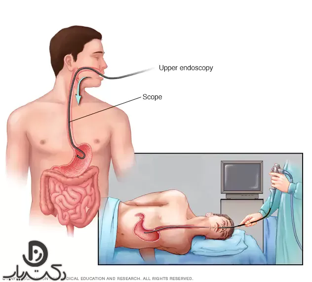 Medical treatment of gastric