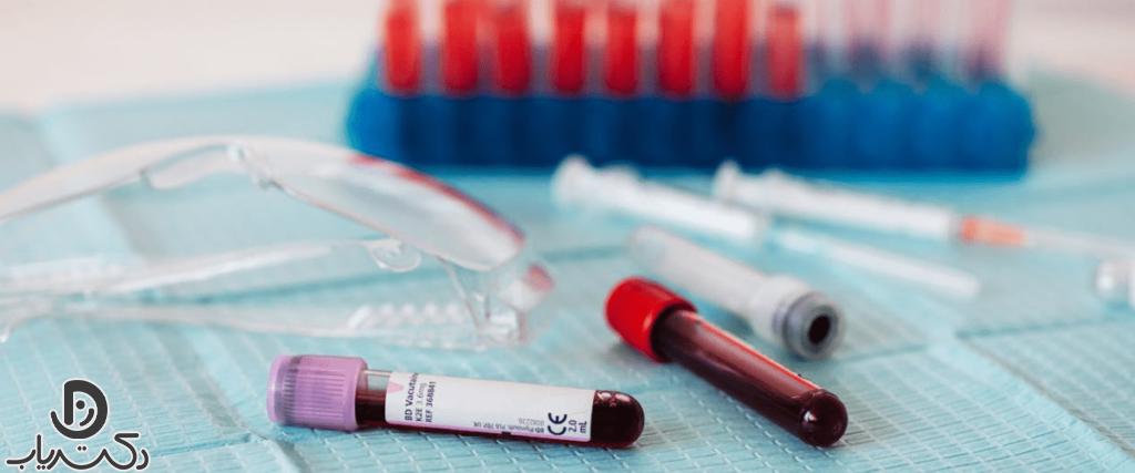 Blood test to diagnose heart disease