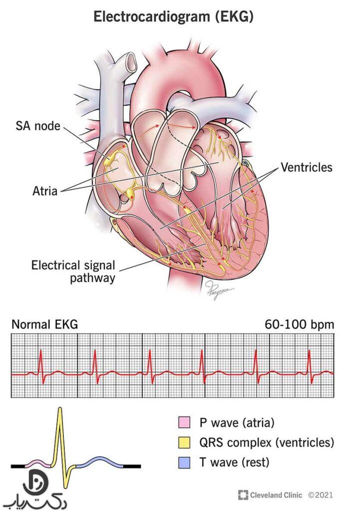 تشخیص بیماری‌های قلبی با نوار قلب: