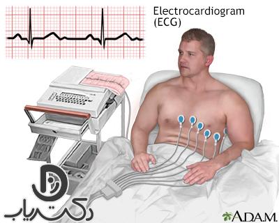 نوار قلب چگونه گرفته میشود ؟