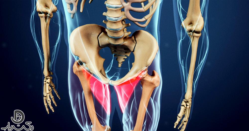 Lumbar disc and groin pain