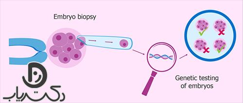 PGD ​​sex determination