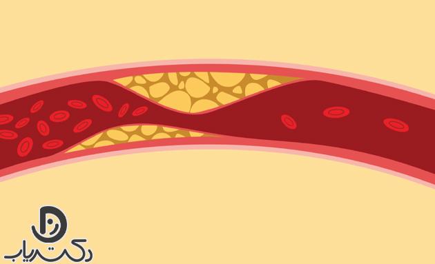 تشخیص بیماری چگونه انجام می شود؟