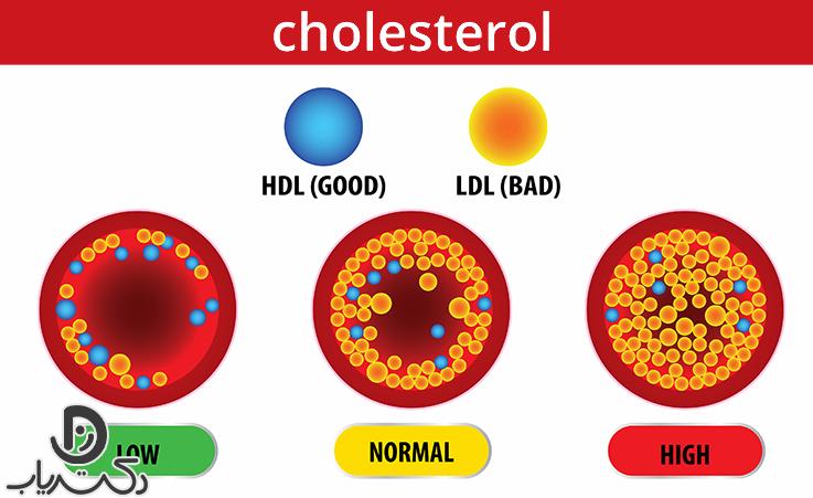 علائم کلسترول بالا چیست؟