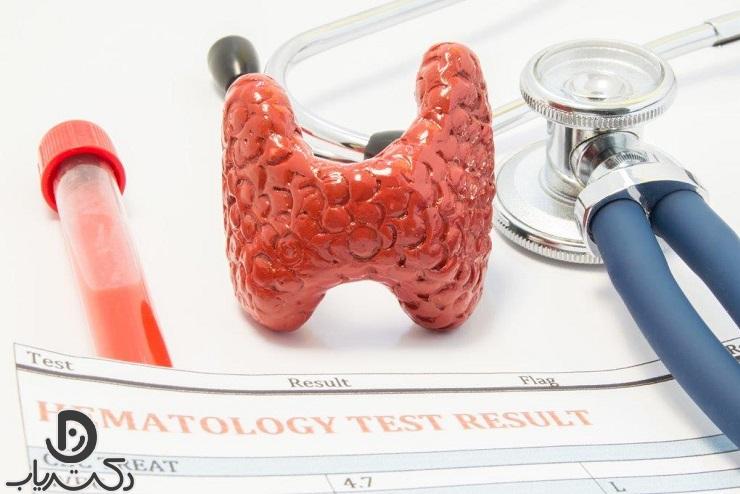 thyroid test5