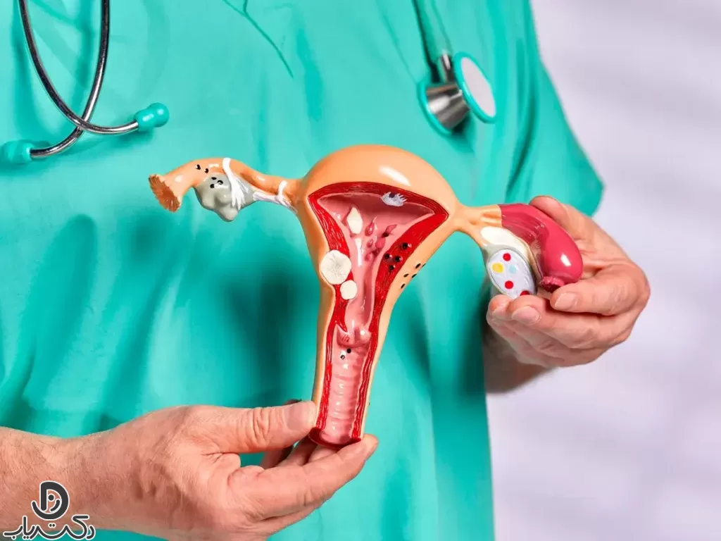 Complications of uterine prolapse